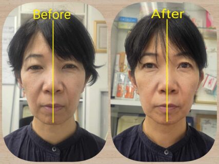 耳つぼストーンセラピスト®誕生！フェイシャルセラピスト